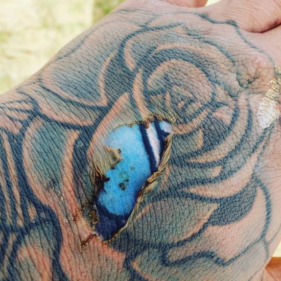 foto di una mano tatuata dopo aver preso sole